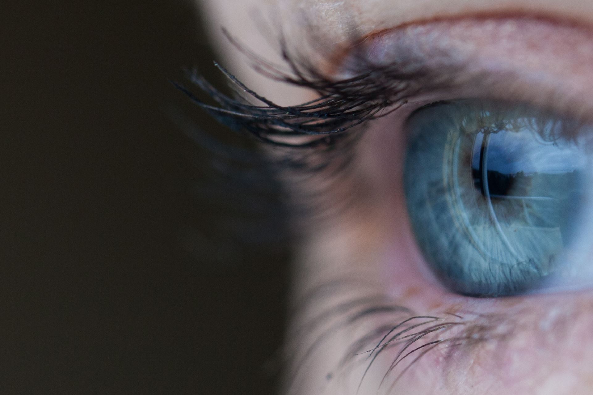 eye (EMDR)